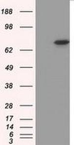 PRKG1 Antibody in Western Blot (WB)