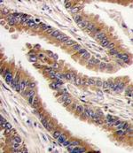 PRKX Antibody in Immunohistochemistry (IHC)