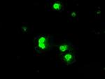 PRKY Antibody in Immunocytochemistry (ICC/IF)