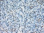 PRKY Antibody in Immunohistochemistry (Paraffin) (IHC (P))