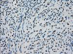 PRKY Antibody in Immunohistochemistry (Paraffin) (IHC (P))