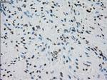 PRKY Antibody in Immunohistochemistry (Paraffin) (IHC (P))
