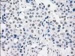 PRKY Antibody in Immunohistochemistry (Paraffin) (IHC (P))