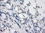PRKY Antibody in Immunohistochemistry (Paraffin) (IHC (P))