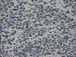 PRKY Antibody in Immunohistochemistry (Paraffin) (IHC (P))