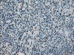 PRKY Antibody in Immunohistochemistry (Paraffin) (IHC (P))