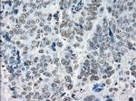PRKY Antibody in Immunohistochemistry (Paraffin) (IHC (P))