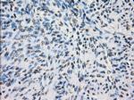 PRKY Antibody in Immunohistochemistry (Paraffin) (IHC (P))
