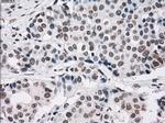 PRKY Antibody in Immunohistochemistry (Paraffin) (IHC (P))