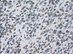 PRKY Antibody in Immunohistochemistry (Paraffin) (IHC (P))
