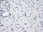 PRKY Antibody in Immunohistochemistry (Paraffin) (IHC (P))