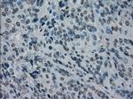 PRKY Antibody in Immunohistochemistry (Paraffin) (IHC (P))