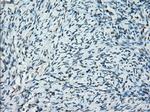 PRKY Antibody in Immunohistochemistry (Paraffin) (IHC (P))