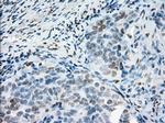PRKY Antibody in Immunohistochemistry (Paraffin) (IHC (P))