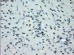 PRKY Antibody in Immunohistochemistry (Paraffin) (IHC (P))