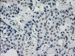 PRKY Antibody in Immunohistochemistry (Paraffin) (IHC (P))