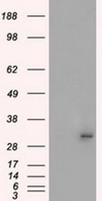 PRKY Antibody in Western Blot (WB)