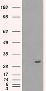 PRKY Antibody in Western Blot (WB)