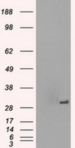 PRKY Antibody in Western Blot (WB)
