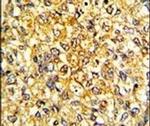 Prolactin Antibody in Immunohistochemistry (IHC)