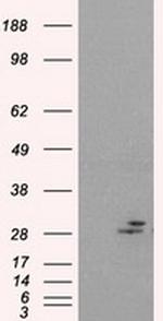 PRL Antibody in Western Blot (WB)