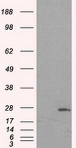 PRL Antibody in Western Blot (WB)