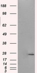 PRL Antibody in Western Blot (WB)
