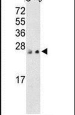 PRL3 Antibody in Western Blot (WB)