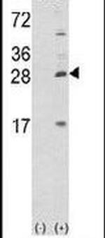 Prolactin Antibody in Western Blot (WB)