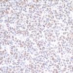 PRMT1 Antibody in Immunohistochemistry (IHC)