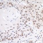 PRMT1 Antibody in Immunohistochemistry (IHC)