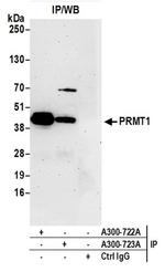 PRMT1 Antibody in Western Blot (WB)