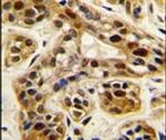 PRMT1 Antibody in Immunohistochemistry (IHC)
