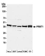 PRMT1 Antibody in Western Blot (WB)