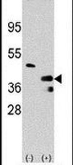 PRMT1 Antibody in Western Blot (WB)