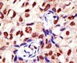 PRMT2 Antibody in Immunohistochemistry (IHC)