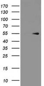 PRMT2 Antibody in Western Blot (WB)
