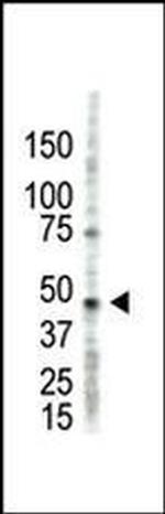 PRMT2 Antibody in Western Blot (WB)