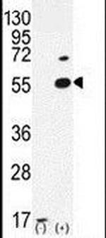 PRMT2 Antibody in Western Blot (WB)