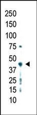 PRMT2 Antibody in Western Blot (WB)