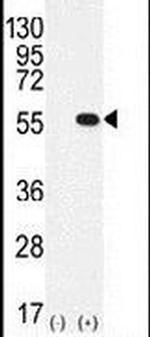 PRMT2 Antibody in Western Blot (WB)