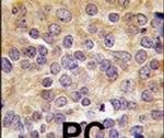 PRMT3 Antibody in Immunohistochemistry (IHC)