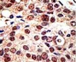 PRMT3 Antibody in Immunohistochemistry (IHC)