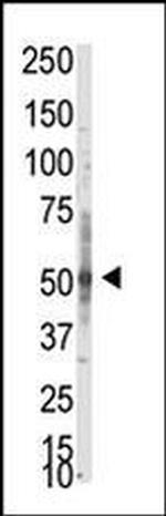 PRMT3 Antibody in Western Blot (WB)