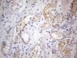 PRMT5 Antibody in Immunohistochemistry (Paraffin) (IHC (P))