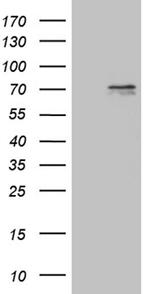 PRMT5 Antibody in Western Blot (WB)