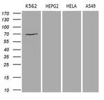 PRMT5 Antibody in Western Blot (WB)