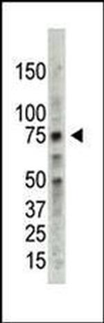 PRMT5 Antibody in Western Blot (WB)