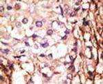 PRMT6 Antibody in Immunohistochemistry (IHC)