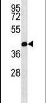 PRMT6 Antibody in Western Blot (WB)